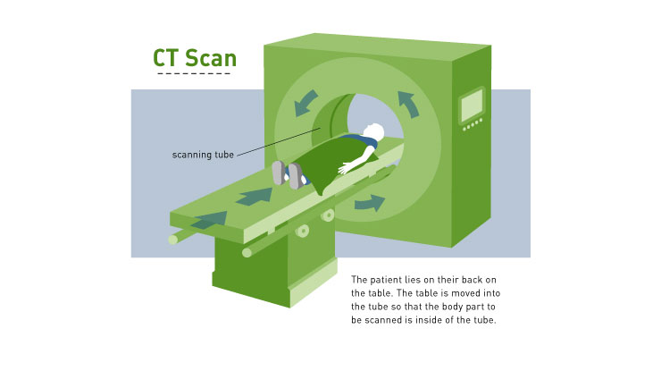Kegunaan CT Scan