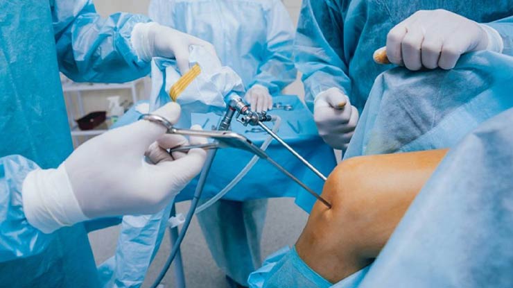 Prosedur Operasi Ligamen Lutut