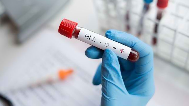 Tujuan TCek HIV
