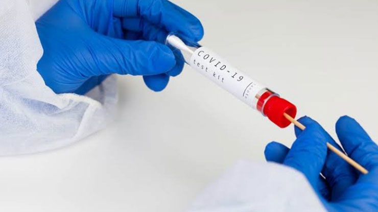 Syarat Test Rapid Antigen