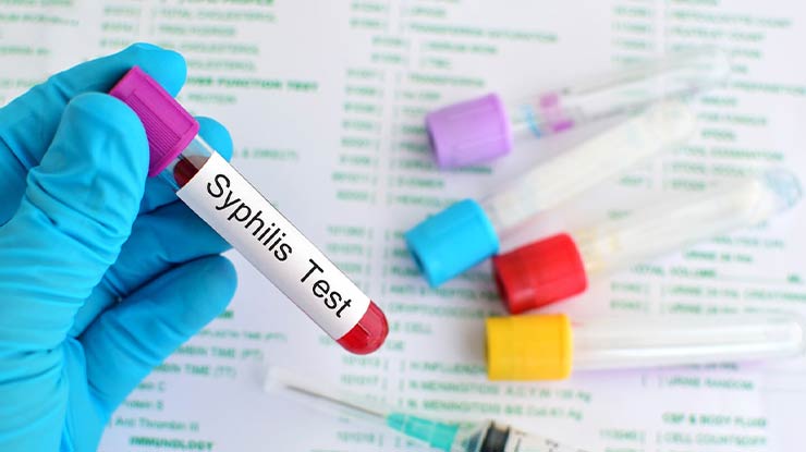 Tips Mencegah Sifilis