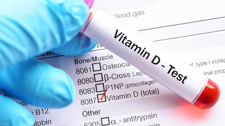 Manfaat Cek Kadar Vitamin D