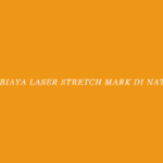 Biaya Laser Stretch Mark di Natasha