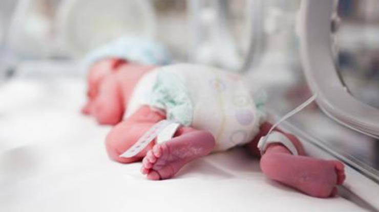 Kondisi Bayi Membutuhkan Inkubator